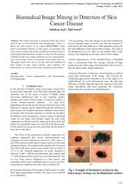 Because it is often caused by exposure to the sun, skin cancer is one of the most common cancers in the world. Top Pdf Biomedical Image Mining In Detection Of Skin Cancer Disease 1library