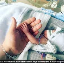 Vim trazer o primeiro diário de gravidez aqui no canal! Bebe Que Nasceu De 22 Semanas E Menor Que A Palma De Uma Mao Desafia Os Medicos Ele E Nosso Milagre Fotos R7 Saude