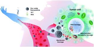 Hearing the doctor tell you that you've got cancer is undoubtedly one of the worst things you may experience. Zinc Oxide Nanoparticles For Therapeutic Purposes In Cancer Medicine Journal Of Materials Chemistry B Rsc Publishing