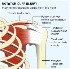 Image result for Rotator Cuff Rupture