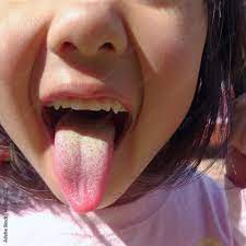 舌を出す女の子 Stock 写真 | Adobe Stock