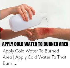 Check spelling or type a new query. Apply Cold Water To Burned Area Apply Cold Water To Burned Area Apply Cold Water To That Burn Water Meme On Me Me