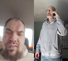 Kevin Thompson Poison