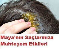 Kadinlara Dair Ne Varsa Hair Loss Treatment Hair Loss Therapy Natural Hair Loss