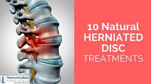10 Natural Herniated Disc Treatments That Don T Require Surgery