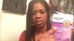 I may never get my follicles i have thick black hair and a family with no history of balding. Womens Hair Loss Treatment Minoxidil Before And After Youtube