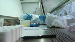 Once the amplification is done (see. Ege Universitesi Kovid 19 Pcr Testi Icin Yetkilendirildi