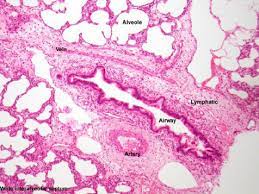 Felekkis histopathology lead 16th of september alveolar lining: Lung Histology Haematoxylin And Eosin Staining Of Case 1 Demonstrates Download Scientific Diagram