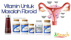 Miom atau fibroid adalah tumor jinak yang tumbuh di dinding rahim. Fibroid Adakah Ia Kanser Yang Berbahaya Siapa Yg Berisiko Untuk Dapat Fibroids Jomsihat