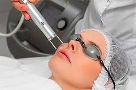 Trattamenti laser Napoli • Dr. Pasquale Verolino