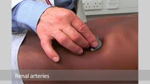 Image result for Succussion Splash