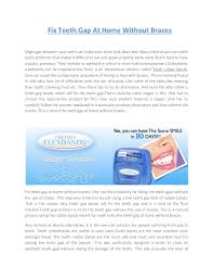 Finding the procedure that will work best for you. Fix Teeth Gap At Home Without Braces Www Orthoflexbands Com