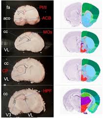 Microrna content of rat organs through deep sequencing and characterization. Collection Of Frozen Rodent Brain Regions For Downstream Analyses Protocol