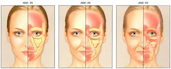 While filler in the checks may only last six months, hyaluronic acid filler under your eyes can last up to a year. Tear Trough Fillers In Melbourne Feel Fresher And Look Less Tired