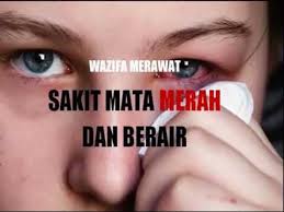 Wazifa Merawat Sakit Mata Merah Dan Berair Penyakit Mata Merah