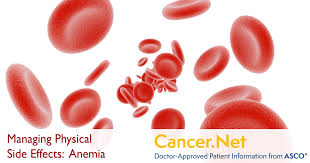 There are three blood cancer types, namely, leukemia, which happens due to uncontrolled production of abnormal white blood cells, lymphoma. Anemia Cancer Net