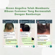 Jadi, rambut rontok yang terjadi setiap hari merupakan kejadian alami dari siklus normal rambut. Pin On Hair Care Penumbuh Rambut Penghilang Uban Penghilang Ketombe