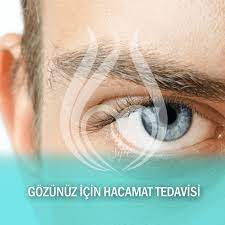 Gozunuz Icin Hacamat Tedavisi Dogal Tedavi Hacamat