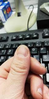 schwarze streifen im daumnagel wer weiss was de