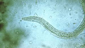 Gut Feelings: Investigating the Promise of Helminths, aka Parasitic Worms