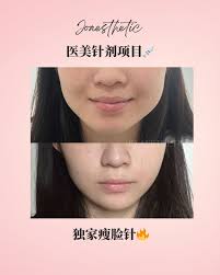 直观比对，美不如真！小姑娘爱死这效果😍