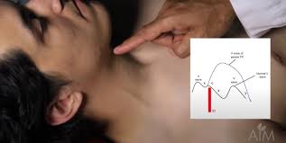 Image result for Neck Exam