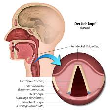 Image result for Epiglottitis