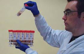 International pathogenic Escherichia coli conference