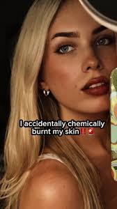#skincare #burn #bha #skintok
