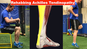 Over time the tendon may become. Rehabbing Achilles Tendinopathy Squat University