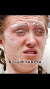 Sarah Watson Plaster Removal Untold Stories