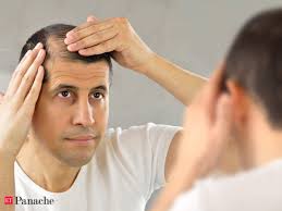 So, too, can baldness cures advertised as magical remedies. Hair Transplant Indian Men Tackling Baldness As Early As In Their 20s The Economic Times