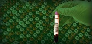 Check spelling or type a new query. Cost Of Blood Work Without Insurance Walkin Lab