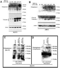 Maybe you would like to learn more about one of these? Disulfiram Suppresses Growth Of The Malignant Pleural Mesothelioma Cells In Part By Inducing Apoptosis