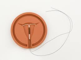 See full list on wikihow.com Which Iuds Are The Best Benefits Risks And Side Effects