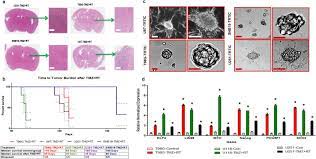 Cells Isolated From Residual Intracranial Tumors After Treatment Express Ipsc Genes And Possess Neural Lineage Differentiation Plasticity Ebiomedicine