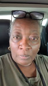 Starting Tepezza infusion treatment