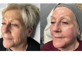 Hair by Chloe strange