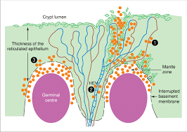 Image result for tonsilla palatina
