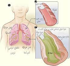 Chronic obstructive pulmonary disease (copd) is a common condition with high morbidity and mortality, affecting males and females equally. ØªÙˆØ³Ø¹ Ø§Ù„Ù‚ØµØ¨Ø§Øª ÙˆÙŠÙƒÙŠØ¨ÙŠØ¯ÙŠØ§