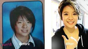 Want To Know All About The Shocking F X Plastic Surgery Plastytalk