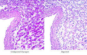 Looking for the definition of pas? Pad 1 Periodic Acid Schiff Pas Diastase Stain Kit Biotrend
