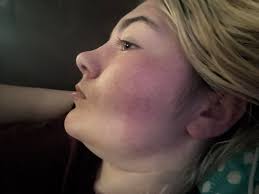 What could be causing my daughter's mysterious rash and tachycardia?