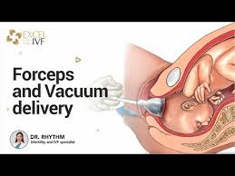 Image result for Forceps Assisted Delivery