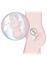 Semana 15 De Embarazo Inatal El Embarazo Semana A Semana