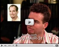 Hair Restoration for Men