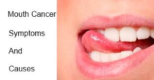 A shallow ulcer on the lower lip Identify Signs Of Mouth Cancer Early For Successful Treatment