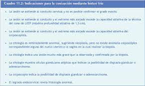 La Colposcopia Y El Tratamiento De La Neoplasia Intraepitelial Cervical Manual Para Principiantes