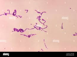 Image result for Group D Streptococcus