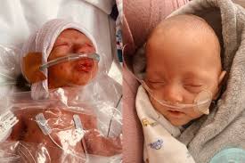 Fundraiser for Miracle Marlette by Jodi Marlette : Miracle Baby Ryland  Marlette-Possible Super Hero?